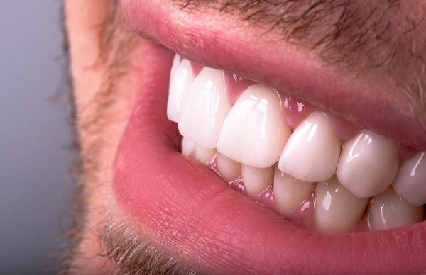 Same Day Crowns Vs  Traditional Crowns: Which Is Right For You?